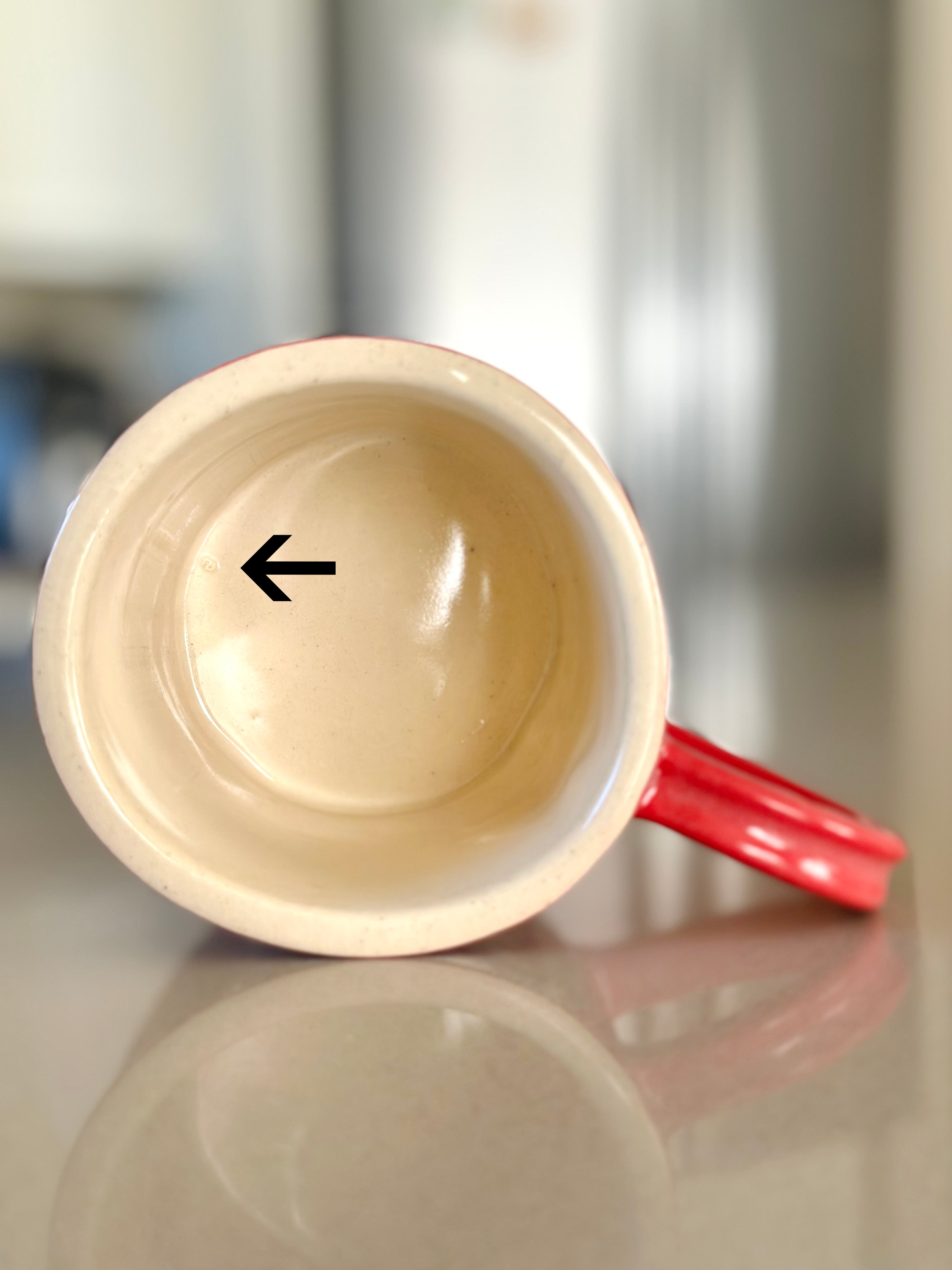 Anatomic Variant 3 Vessel Runoff Mug (Nodule Nelly)